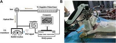 Evaluation of Tracheal Stenosis in Rabbits Using Multispectral Optoacoustic Tomography